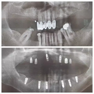 Slider image (8) Prestij Dental Clinic